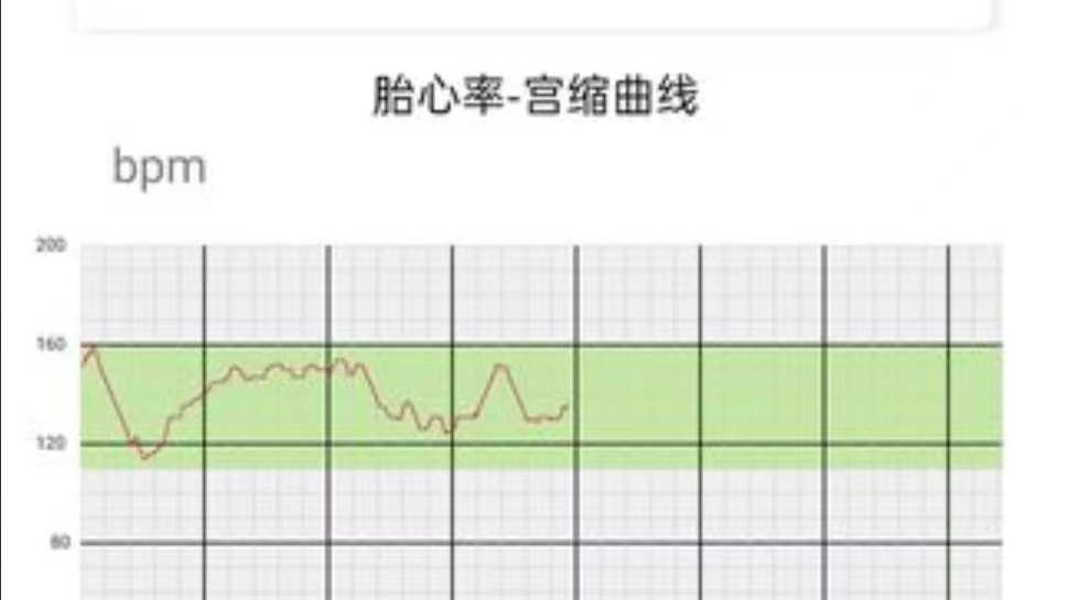 最新最值得下载的怀孕app有哪些