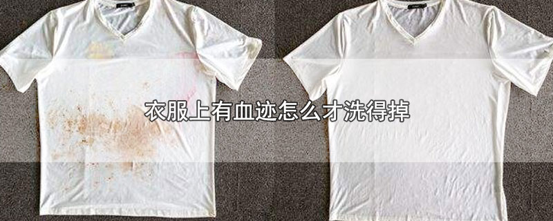 衣服上有血迹怎么才洗得掉-最新衣服上有血迹怎么才洗得掉整理解答