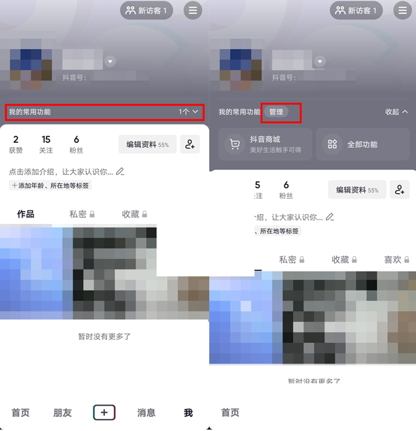 抖音常用功能管理方法-抖音怎么设置常用功能