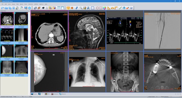 Sante DICOM Viewer(医疗办公软件) v11.8.8下载-PC资源Sante DICOM Viewer(医疗办公软件) v11.8.8下载